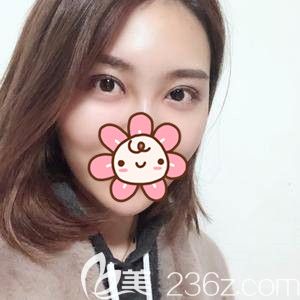 拆線第三天眼睛恢復(fù)情況 拆線第三天眼睛恢復(fù)情況