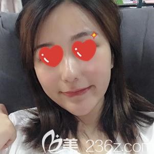 葉凡醫(yī)生幫我做自體脂肪填充術后8天面部腫脹 葉凡醫(yī)生幫我做自體脂肪填充術后8天面部腫脹