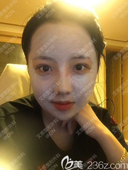 艾恩整形術(shù)后第11天 艾恩整形術(shù)后第11天