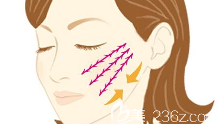 對于做完埋線提升后非常腫脹的求美者來說冷敷和熱敷必不可少