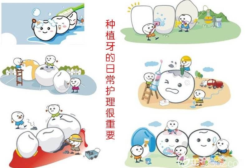 種植牙術(shù)后護(hù)理 種植牙術(shù)后護(hù)理