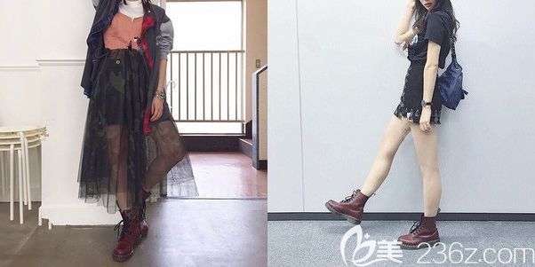 面診南京韓辰前大腿較粗 面診南京韓辰前大腿較粗