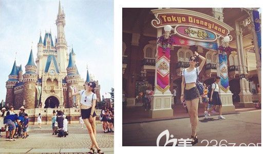 南京韓辰吸脂瘦大腿術(shù)后良心評價(jià)：恢復(fù)期是真的疼不過腿圍真的會變小