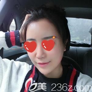 到軍大整形做自體脂肪面部填充術(shù)后15天依舊腫脹 到軍大整形做自體脂肪面部填充術(shù)后15天依舊腫脹