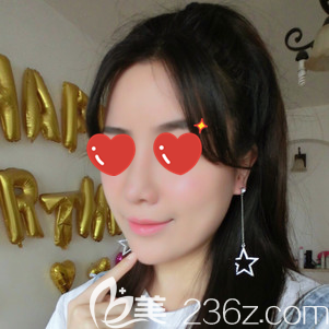 額頭凹陷選做脂肪填充面部的恢復(fù)期確實(shí)很難熬，但效果挺不錯(cuò)