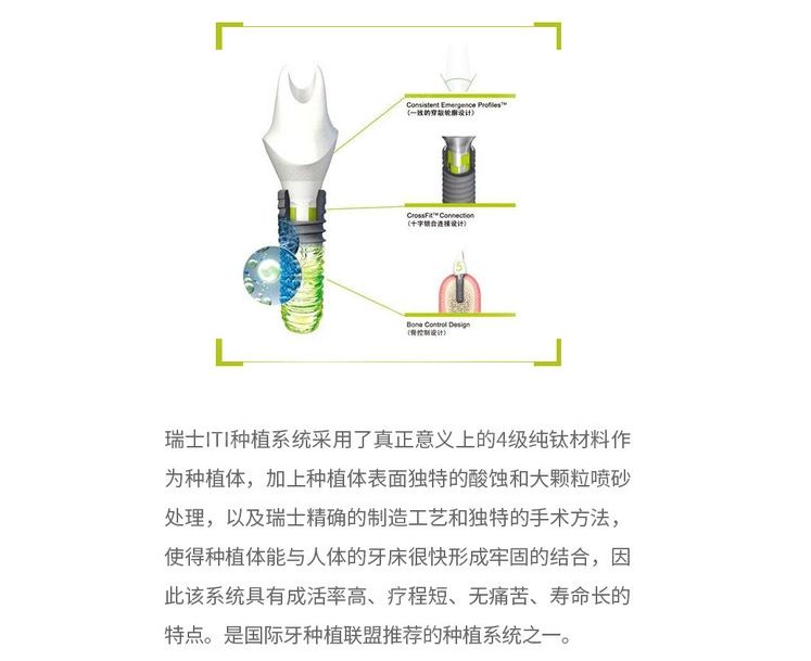瑞士iti種植體優(yōu)點介紹