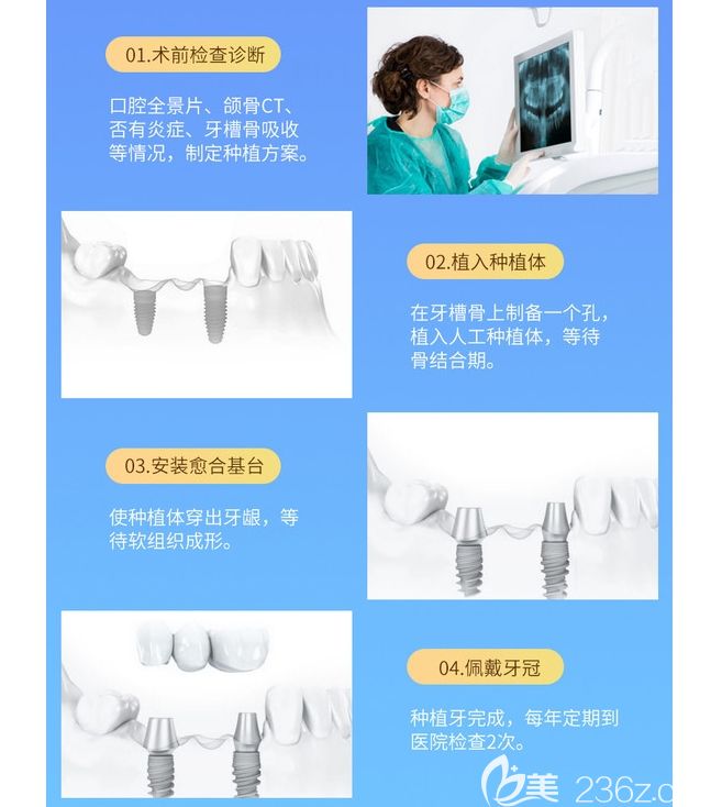 維樂(lè)口腔做種植牙步驟圖示