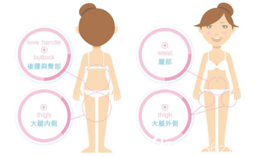 吸脂后要兩周內(nèi)都穿塑身衣