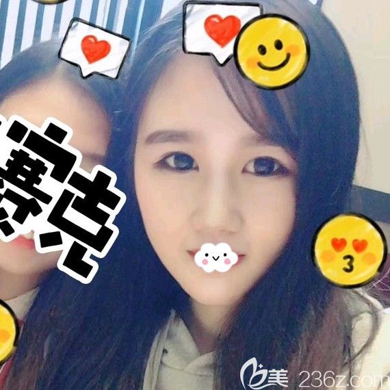 武漢墊下巴哪家醫(yī)院好？卓美硅膠假體墊下巴案例