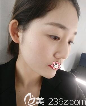 術(shù)前的我 術(shù)前的我