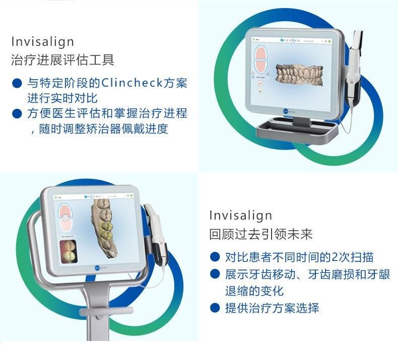 iTero隱適美口掃優(yōu)勢(shì)