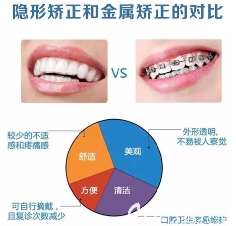 隱形矯正和金屬矯正對(duì)比圖告訴你哪種好