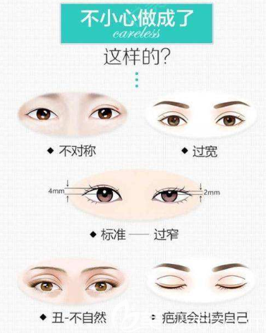 哪些眼睛需要做雙眼皮修復(fù) 哪些眼睛需要做雙眼皮修復(fù)