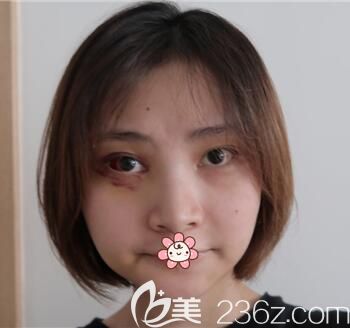 20天后