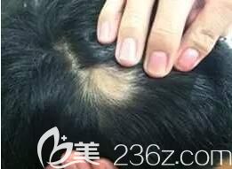 早上掉頭發(fā)的地方