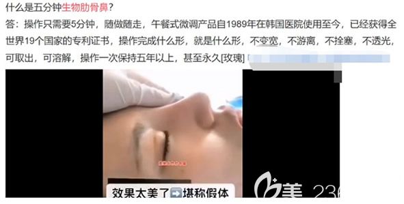 什么是五分鐘生物肋骨鼻 什么是五分鐘生物肋骨鼻