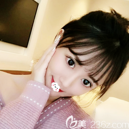 鼻子塌鼻頭大別擔(dān)心,可以通過做假體隆鼻和自體耳軟骨墊鼻尖來讓鼻子變高變挺哦