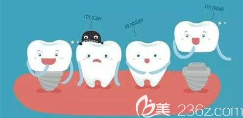 牙齒缺失做種植牙好還是烤瓷牙好 牙齒缺失做種植牙好還是烤瓷牙好