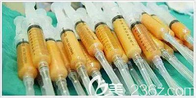 手臂吸脂量是因人而異的