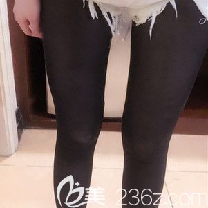 想知道“躺著就能瘦”的大腿吸脂效果好不好，那就點(diǎn)這里.....