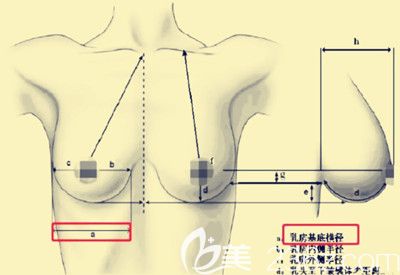 決定隆胸假體大小的標(biāo)準(zhǔn)