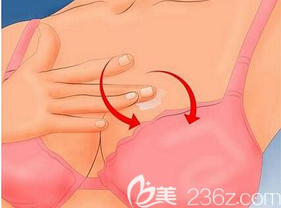 做完假體豐胸后建議定期按摩