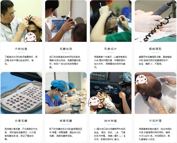 成都絲恒植發(fā)流程展示