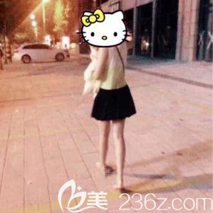 大腿環(huán)吸后晚上真的超級(jí)疼，但看到效果后說(shuō)句實(shí)話不后悔