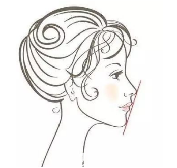 其實(shí)凸嘴除了靠做雙鄂手術(shù)可以解決之外還有很多方法