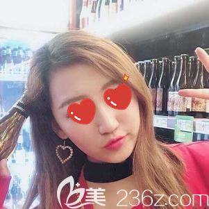 脂肪填充面部術后15天腫脹漸消