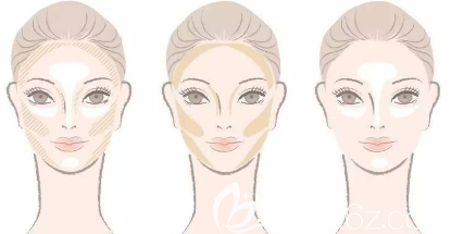 面部削骨手術(shù)