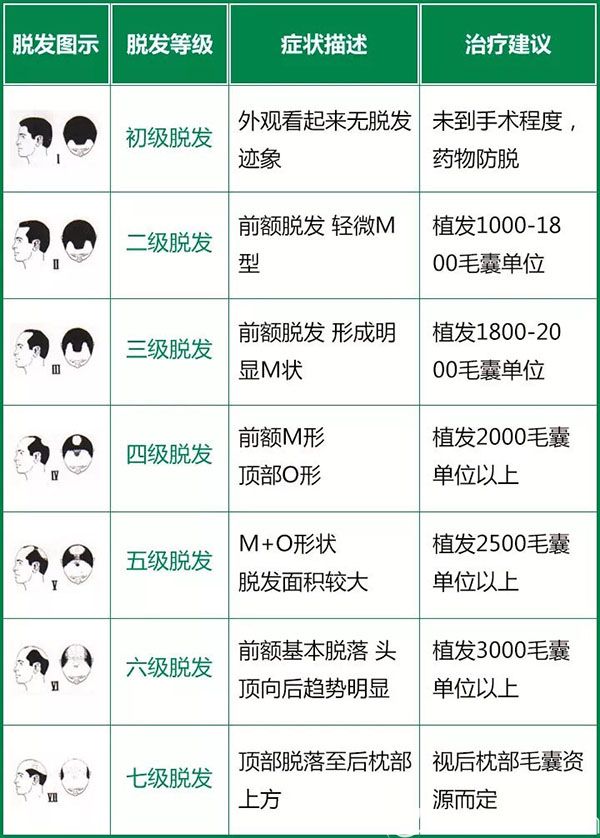 脫發(fā)等級示意圖（參考）