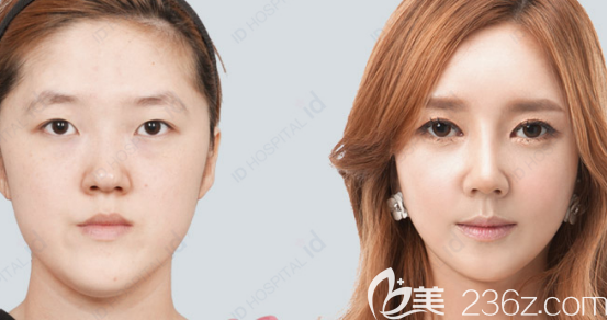 希望害怕做輪廓手術(shù)的妹子們可以通過我分享的經(jīng)歷得到一些勇氣 希望害怕做輪廓手術(shù)的妹子們可以通過我分享的經(jīng)歷得到一些勇氣