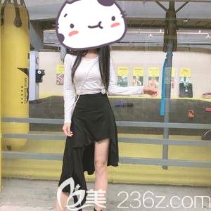 大腿吸脂恢復(fù)期太難受 可是看到術(shù)后3個(gè)月變細(xì)的長(zhǎng)腿覺得這一切都值了