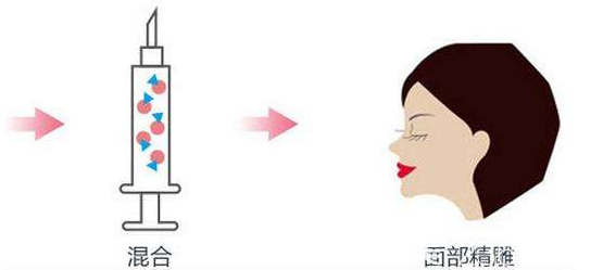 切記要想提高自體脂肪填充全臉后的成活率就不能熱敷冷敷或者做劇烈的運(yùn)動(dòng)