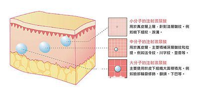 玻尿酸也是分大小分子的