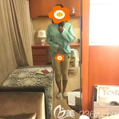 術(shù)后半個月穿塑身褲照片
