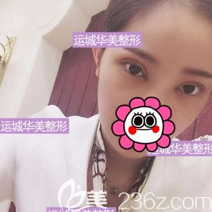 術(shù)后10天到院拆線眼睛輕微紅腫