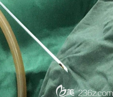 抽脂用的針眼