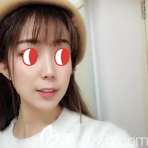 埋線提升術(shù)后25天沒(méi)有出現(xiàn)紅腫 埋線提升術(shù)后25天沒(méi)有出現(xiàn)紅腫