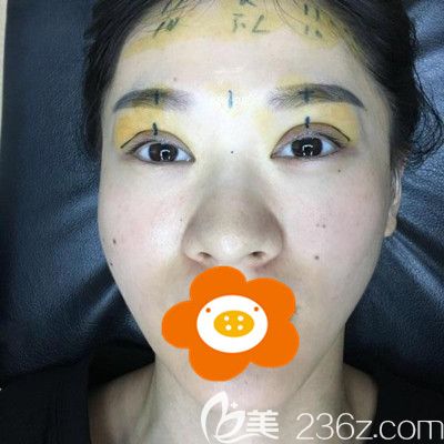 手術(shù)前躺在病床上醫(yī)生為我劃線 手術(shù)前躺在病床上醫(yī)生為我劃線