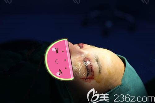 眼部修復(fù)手術(shù)過程中 眼部修復(fù)手術(shù)過程中