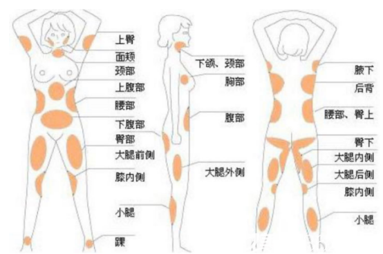 全身吸脂可劃分部位