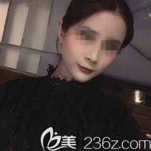 想改善面頰凹陷和淚溝做一次脂肪填充全臉手術(shù)就輕松搞定了