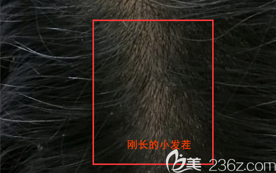 我精心呵護(hù)下長(zhǎng)得小毛茬啊