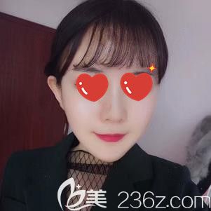 本來就是圓臉還被醫(yī)生推薦做脂肪填充，想知道到底是什么鬼花1分鐘看完這篇文章就了解了