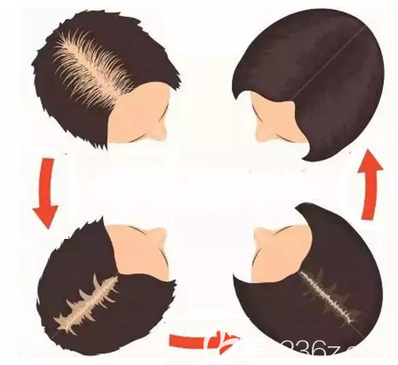 使用密發(fā)小棕瓶的恢復(fù)過程