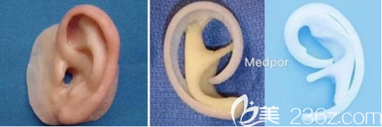 義耳的樣子 義耳的樣子