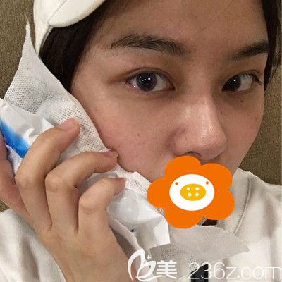 20200303_1583224725397784.jpg 術(shù)后冰敷_副本.jpg