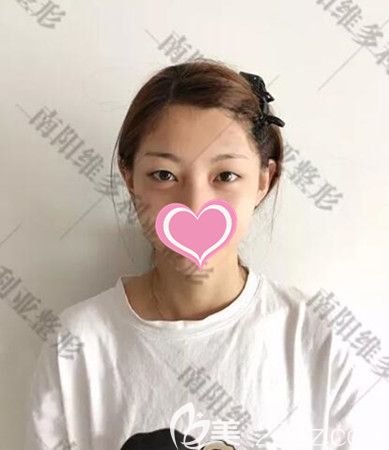 術(shù)前照片 術(shù)前照片